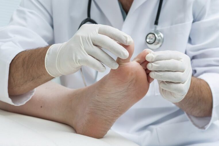 A doctor's examination with the presence of Mikosis