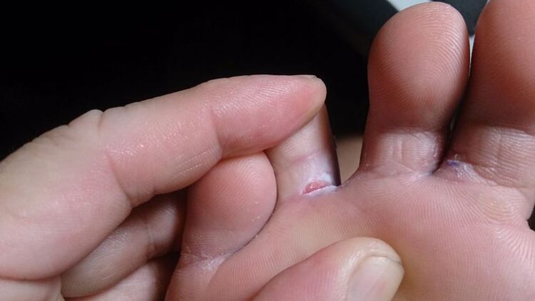Mushrooms between fingers
