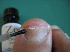 put varnish